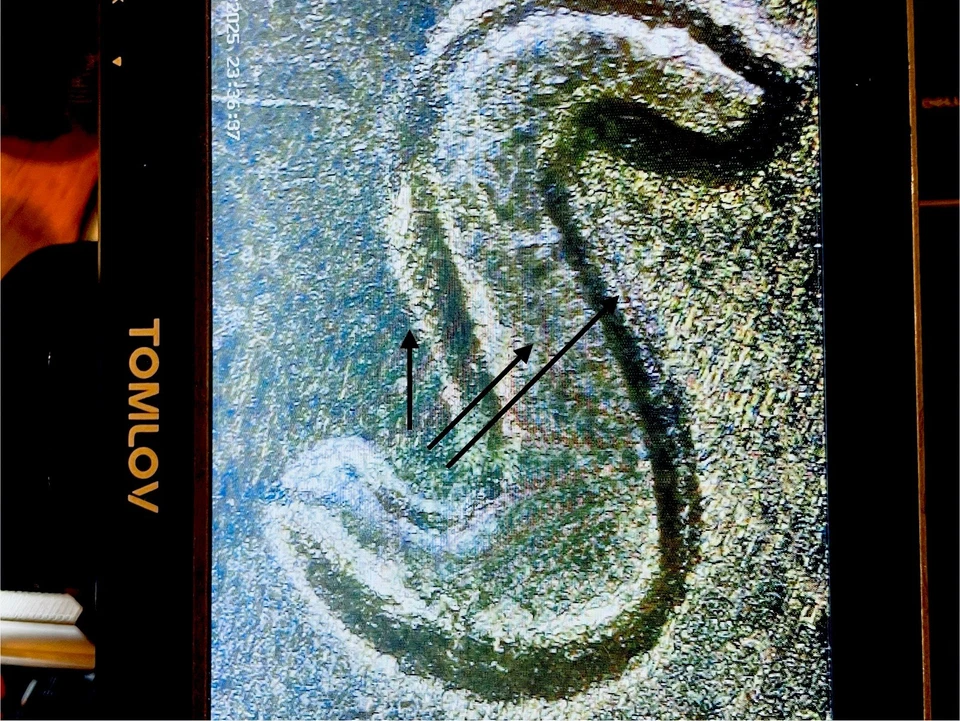 True Tripled Die Reverse Mint Error! 1979 D Roosevelt Dime Uncirculated US Coin - Image 4 of 4