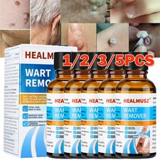 Wart Remover Fast Acting and Painless,Wart Remover Liquid for Face, Hands  Body