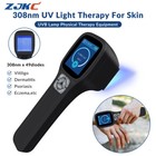 308nm Excimer System Home Phototherapy Uvb Lamp for Skin Diseases Therapy Black