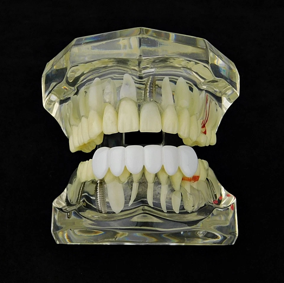 Pure White Teeth Grillz Bottom Teeth Six PC Hip Hop Mouth Grill Pre-Made Grills - Image 4 of 4