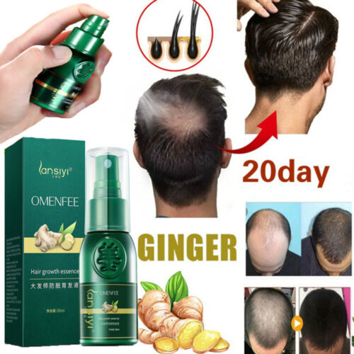 Fast Hair Growth Ginger Serum Spray Loss Treatment Natural Essence for Men  Women | eBay