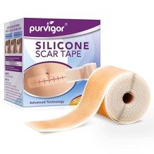 Silicone Scar Tape Roll, 1.6  x 60  Medical for 1.6  x 60  