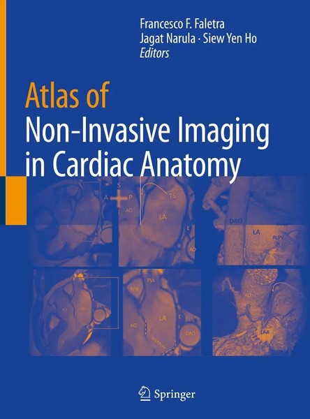 Francesco F. Faletra (U. A.) | Atlas Of Non-Invasive Imaging In Cardiac Anatomy-image