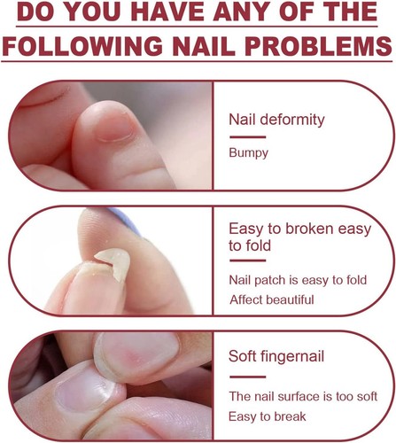 Nail Glue Instant Cracked Nail Repair Gel Nail Fixer for Nail Sculpture Gel 8m - Picture 2 of 7