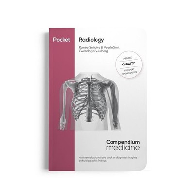 Pocket Radiology: An essential pocket-sized book on diagnostic imaging and radio