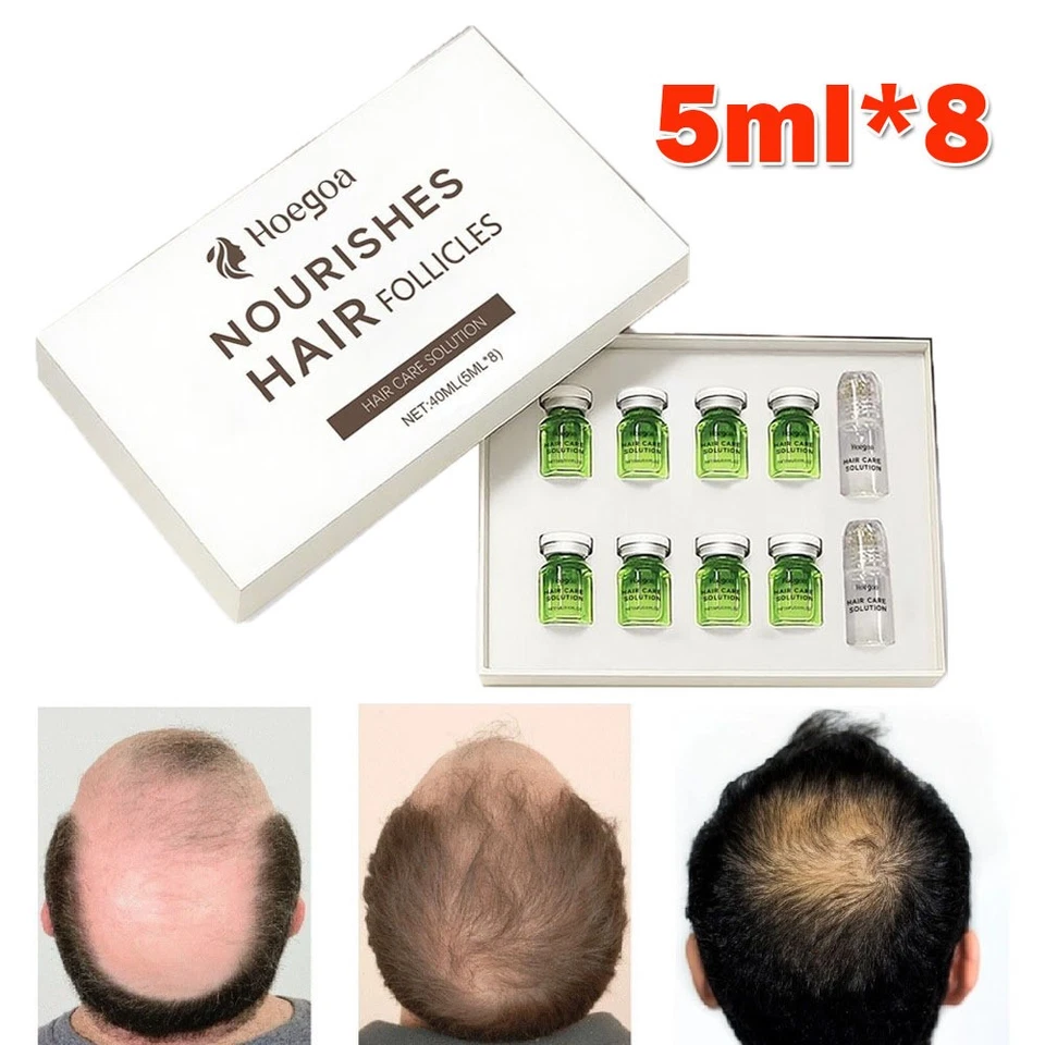 Hair Regrowth System, Advanced Hair Growth Treatment Ginseng 8x5ml Fast Regrowth - Image 3 of 4