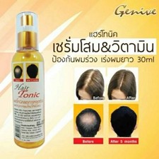 GENIVE Hair Tonic Stop, Reduce Hair Loss  Create New Hair replacement 120ml