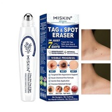 Hiskin 7 Day Skin Tag  Spot Eraser Beauty Rolerball Pen Smooths Softens Skin