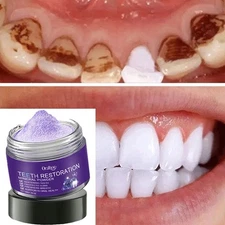 Dental Restoration Mineral Powder, Mineral Tooth Powder, Teeth Whitening Powder