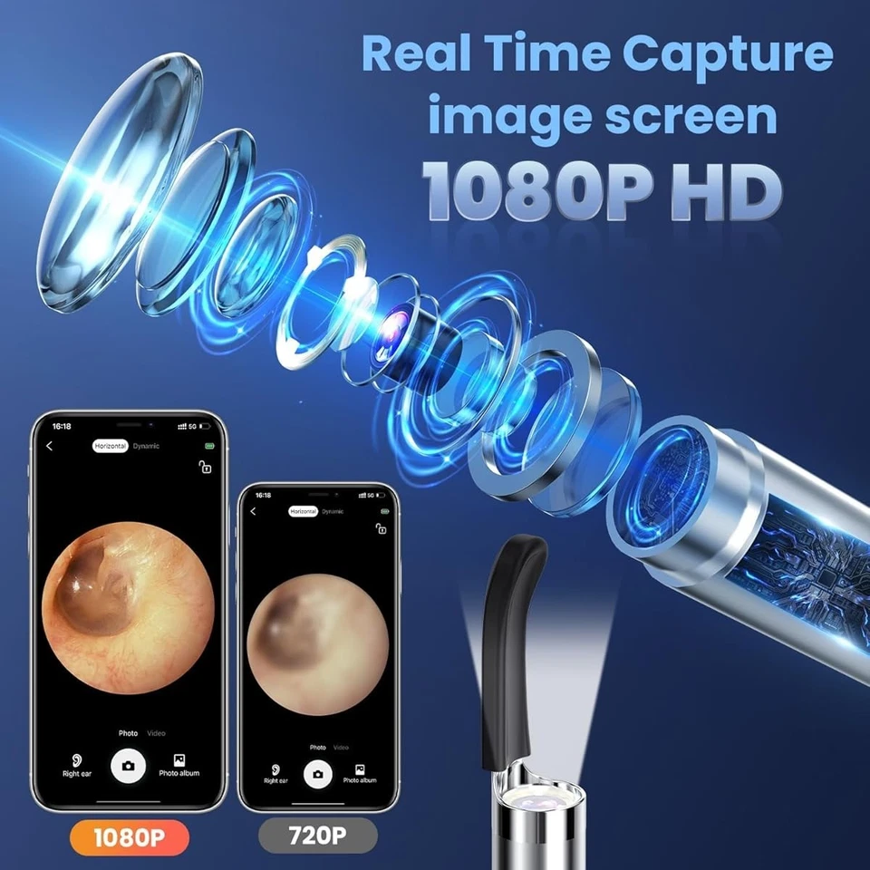 Limpiador removedor de cera de oído 1080P con herramienta de cámara otoscopio impermeable regalos Foto 2 de 4