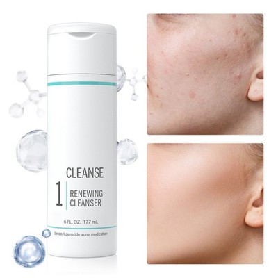 Proactiv Renewing Cleanser 6oz 60 Day Proactive Face Wash Solution Formula`