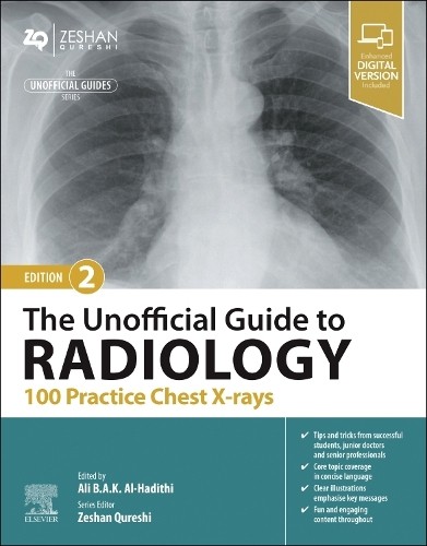 The Unofficial Guide To Radiology: 100 Practice Chest X-Rays Ali B.a.k., Mb Bchir, Ma(Cantab), Mrcp(Uk), Afhea, Pgcert Al-Hadithi - Image 5