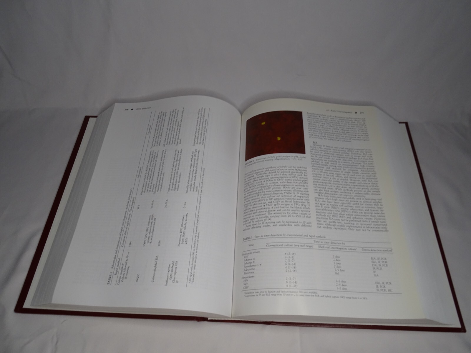 Manual of Clinical Laboratory Immunology by Noel R. Rose (2002 ...