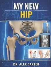 My New Hip: The Complete Guide to Hip Replacement Surgery, Recovery, Rehab, Pain