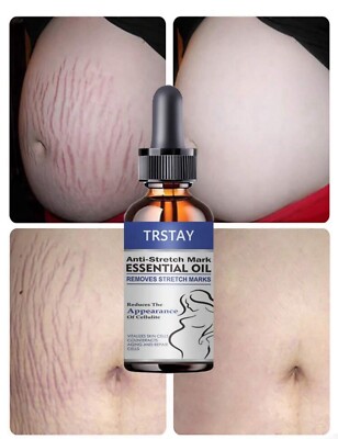 stretch marks Moisturize, Smooth, Firm, Repair