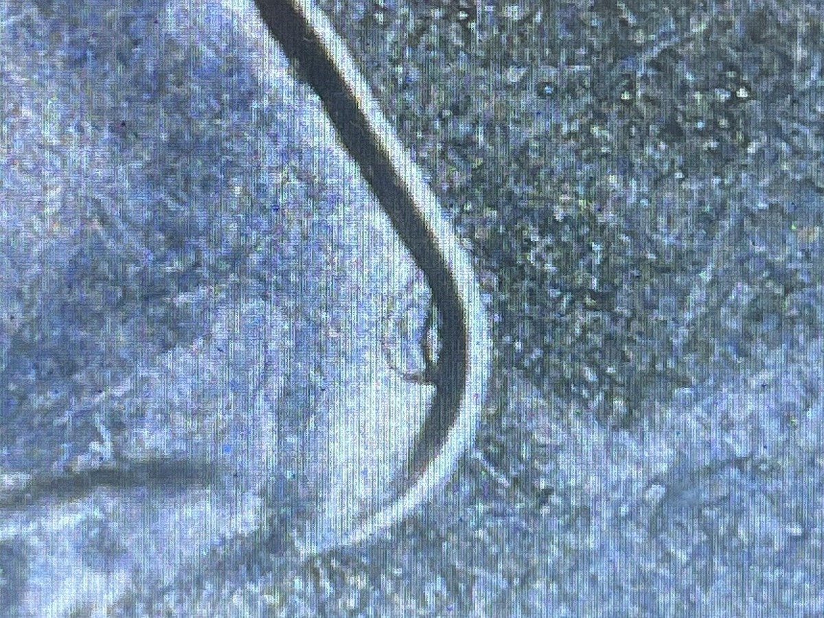 2023 P Edith Kanaka'ole American Women Quarter Error, Nose