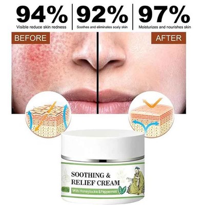 Soothing & Relief Cream Natural Herbal Cream Gentle Instant Soothing and Repair.