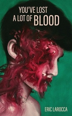 Eric Larocca You've Lost a Lot of Blood (Paperback)