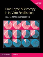 Time-Lapse Microscopy in In-Vitro Fertilization Hardback with
