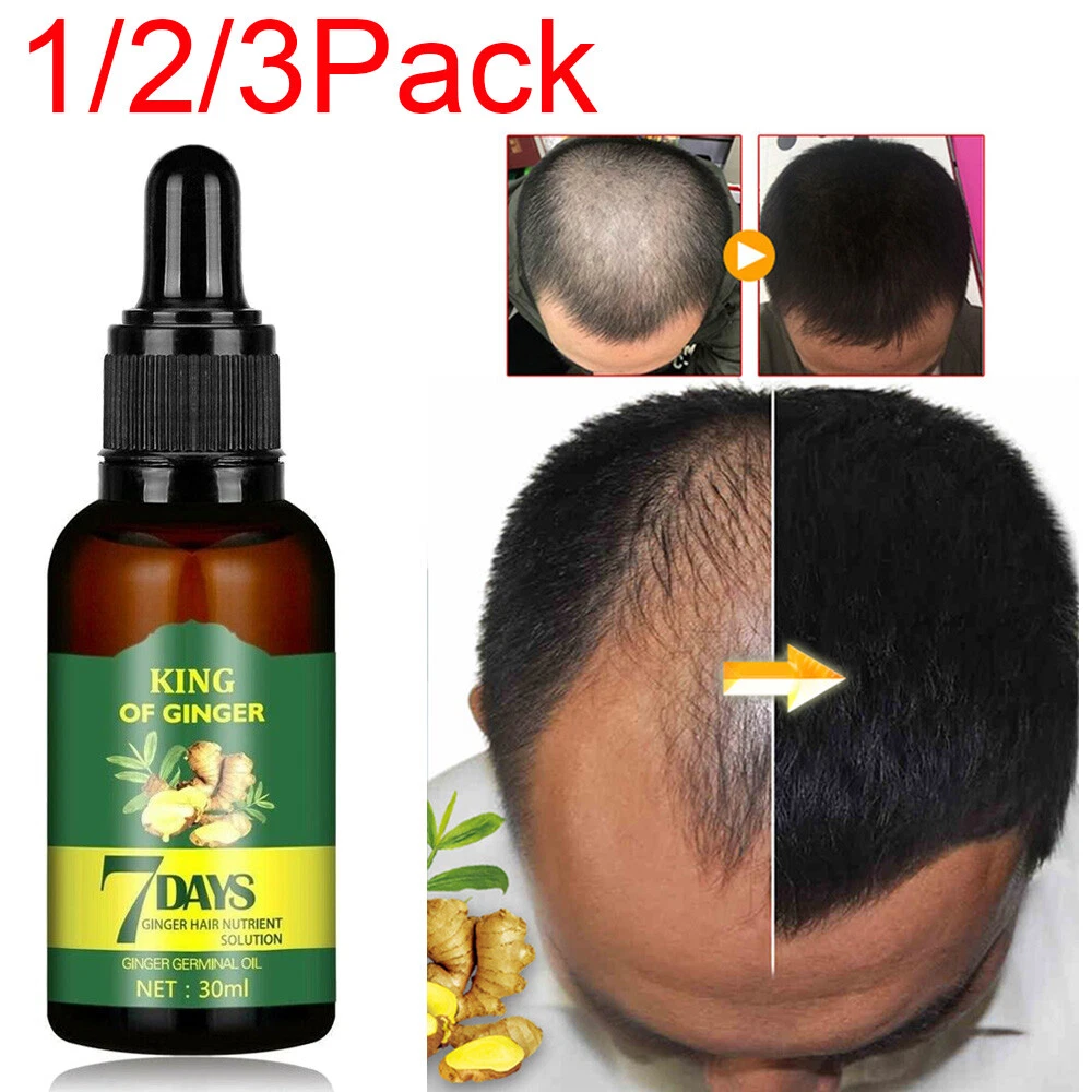 Top more than 146 ayurvedic hair treatment best camera.edu.vn