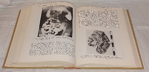Abdominal Operations -Volume 2 6th Edition Maingot 1974 Appleton Century Crofts - Picture 9 of 14