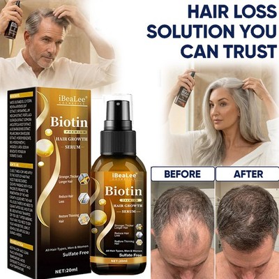 3PCS Biotin Hair Growth Spray Anti Hair Loss Fast Regrowth Scalp Treatment Serum
