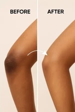 Best Whitening Cream Removing Dark Spot for Knuckle &Toes Elbow & Knee Black Ski