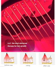 Best infared Laser Hair Growth Helmet - Hair Loss Treatments For Men  Women