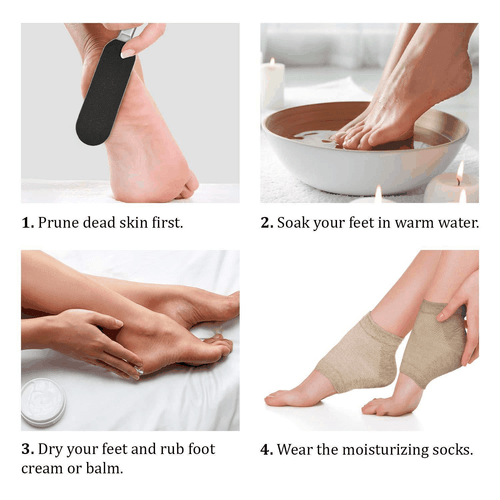 Moisturizing Heel Socks with Soft Gel Lining Dry Cracked Feet Treatment - Picture 5 of 7
