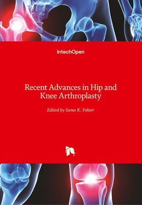 Recent Advances in Hip and Knee Arthroplasty Samo Fokter