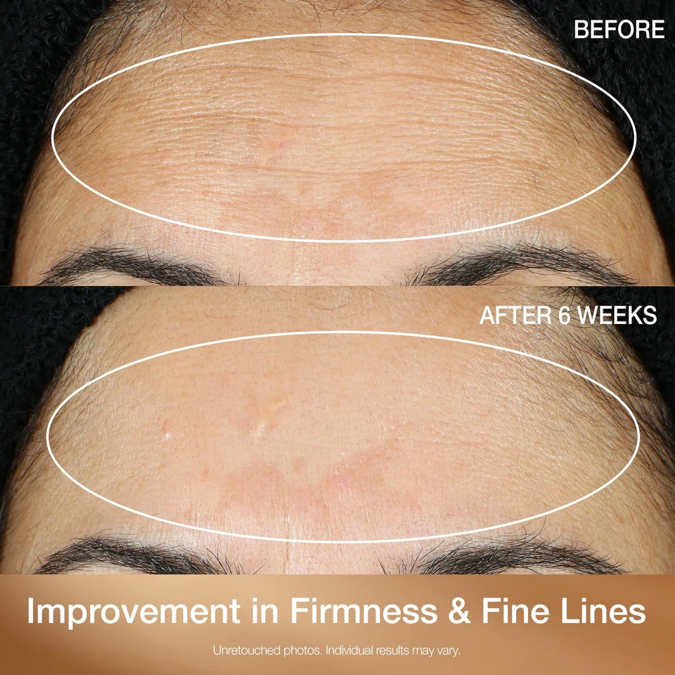 StriVectin Multi Action Super C Retinol Brightening  Correcting Serum 1.7oz - Image 4 of 4