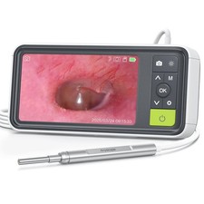 1080P Digital Otoscope Ear Camera 3.9mm with 6 Lights, 4.5" Screen, 32GB, Vid...