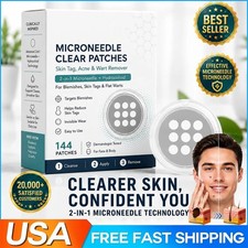 NEW Curalona Microneedle Patches 144pcs, Skin Tag Wart Acne Remover Patches