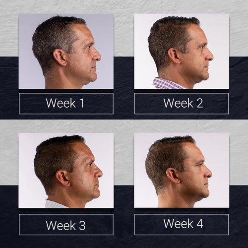 Crema Youthair, acondicionador restaurador de color, fórmula, 3,75 onzas - Imagen 4 de 12