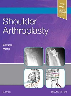 Shoulder Arthroplasty - Hardcover, by Edwards MD T. Bradley; Morris MD - New