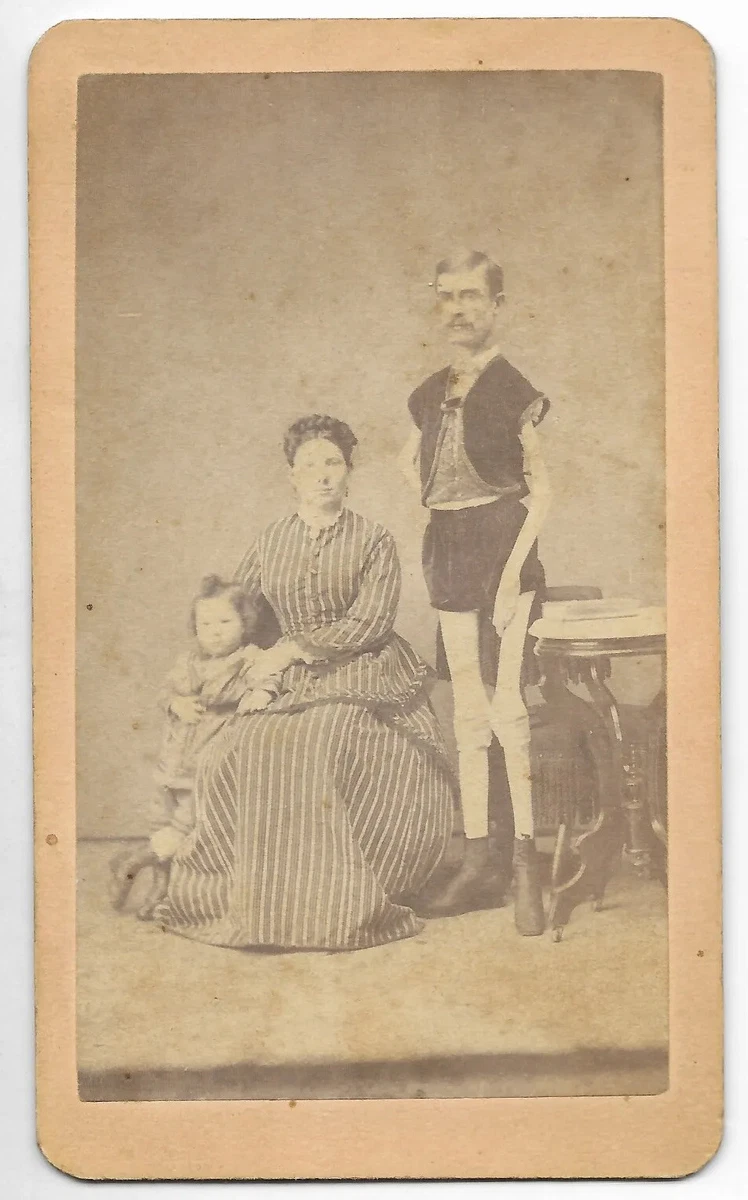 Antique LIVING SKELETON Isaac Sprague CIRCUS SIDESHOW Freak Show CDV PHOTO  | eBay