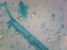 Slide, Anabaena; Blue-green Algae; Filamentous Cyanobacteria; Shows Heterocysts