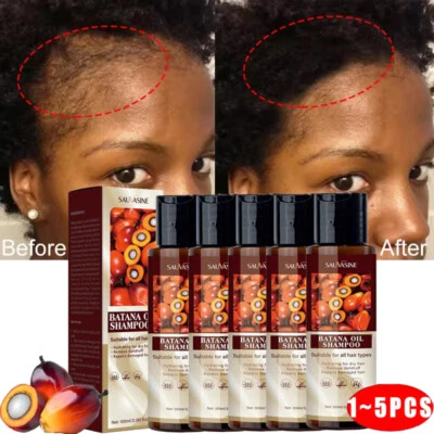 SAUVASINE 1-5X Batana Oil Shampoo Fast Hair Growth Anti hair loss treatment For Men&Women