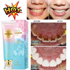 Niacinamide Whitening Toothpaste,Natural Niacinamide Toothpaste,Teeth Whitening