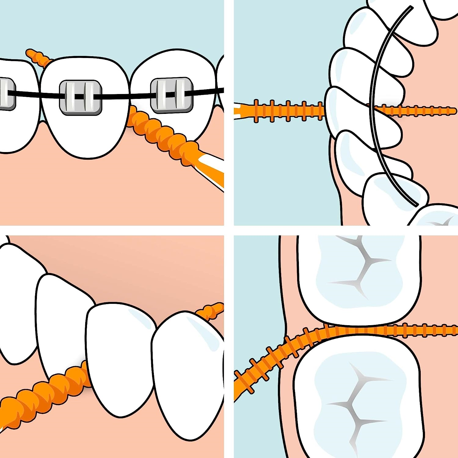 TEPE Easypick Dental Picks, Size Xs/S, orange, Pacl of 36 7317400015811