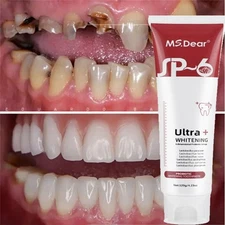 Kids Rotating Electric Toothbrush Rechargeable With 4 Brush Heads 3 Modes Timer