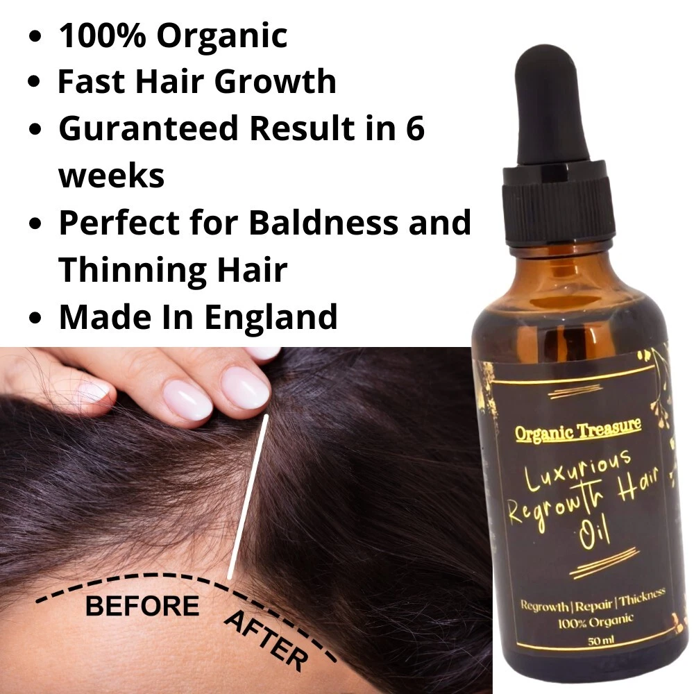 Hair oil for hair loss deals