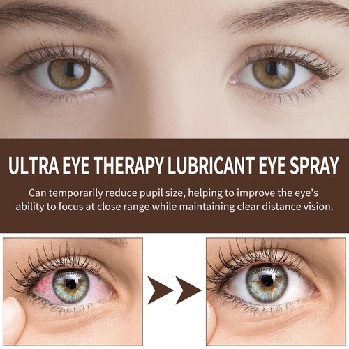 Augenspray für trockene Augen. Natürliches, schmierendes Augenspray. Trockene - Bild 10 von 12