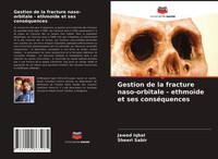 Jawed Iqbal (U. A.) | Gestion De La Fracture Naso-Orbitale - EthmoïDe Et Ses...