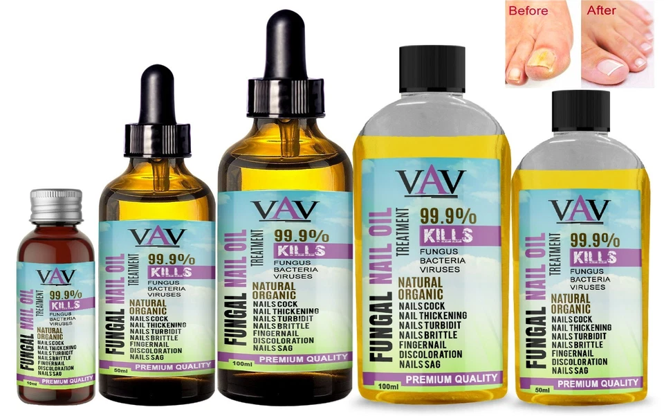 VAV Fungal Nail Infection Treatment 100% effective Fast Acting Anti Bactrial UK