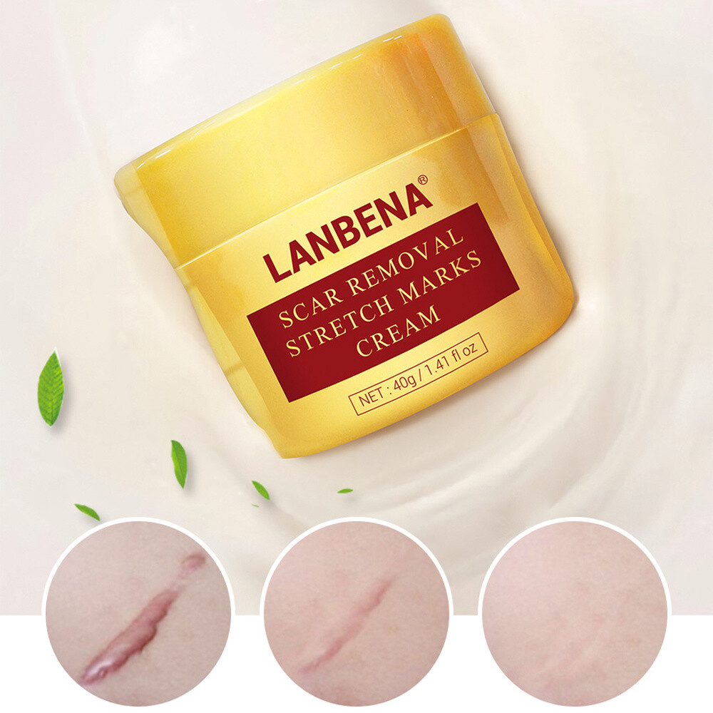 lanbena for stretch marks