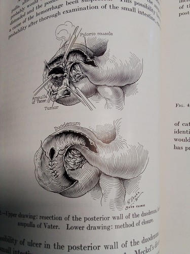 1932 Collected Papers of the Mayo Clinic and The Mayo Foundation Volume XXIII - Picture 8 of 10