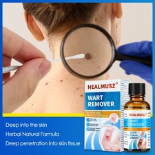 HEALMUSZ Plantar Warts Remover for Body, Natural Salicylic Acid Fast Acting Hot