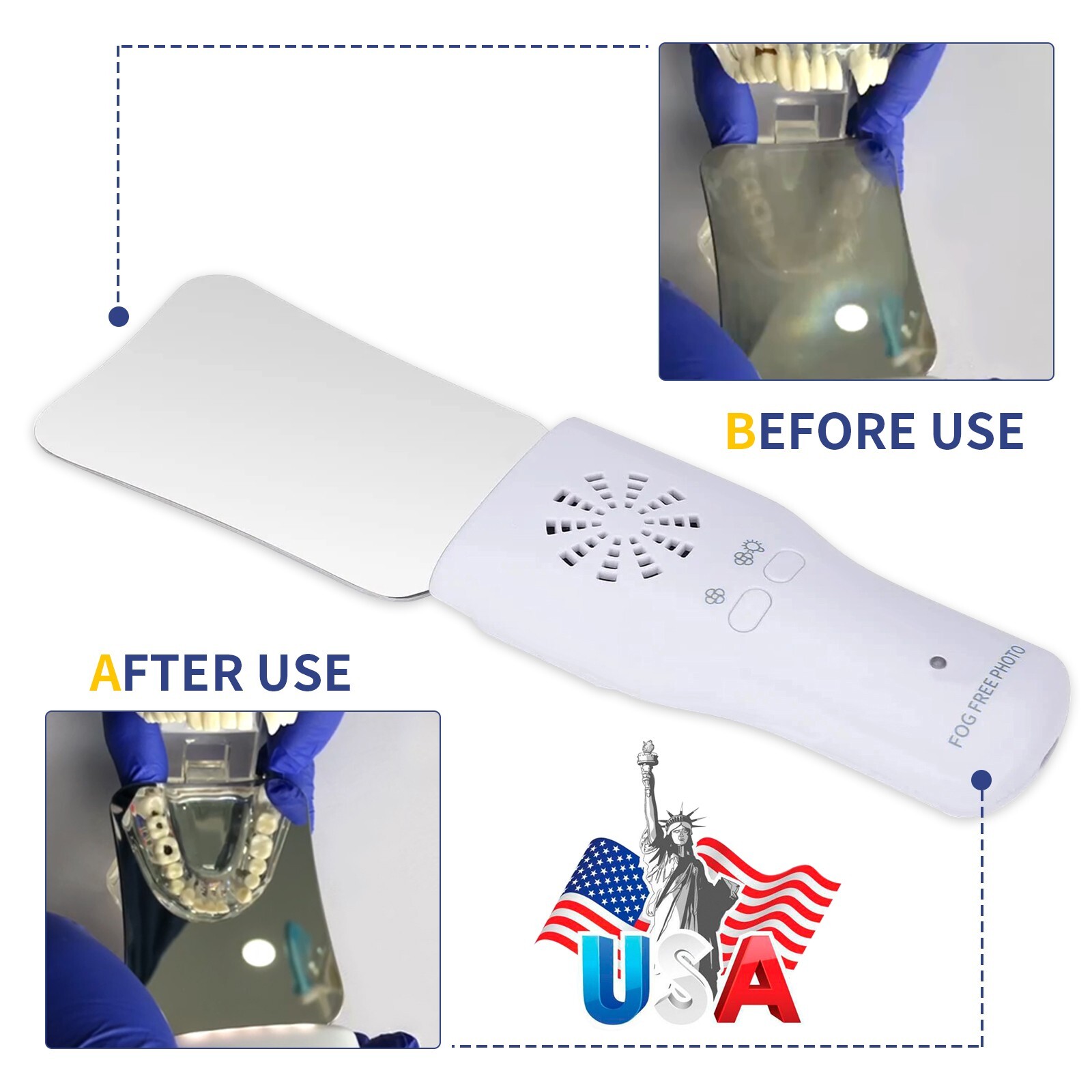 Dental Occlusal Mirror Fog Free LED Intra Oral Photo System 4*Mirrors