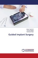 Aakash Agnihotri (U. A.) | Guided Implant Surgery | Taschenbuch | Englisch